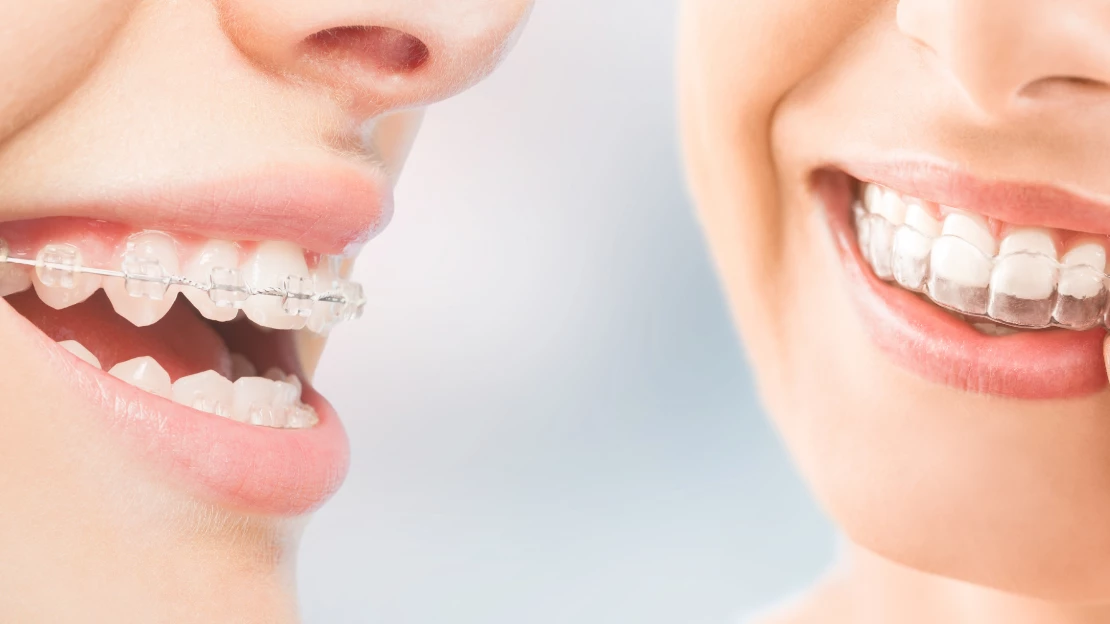 BLOG Benefits of Ortho.pn