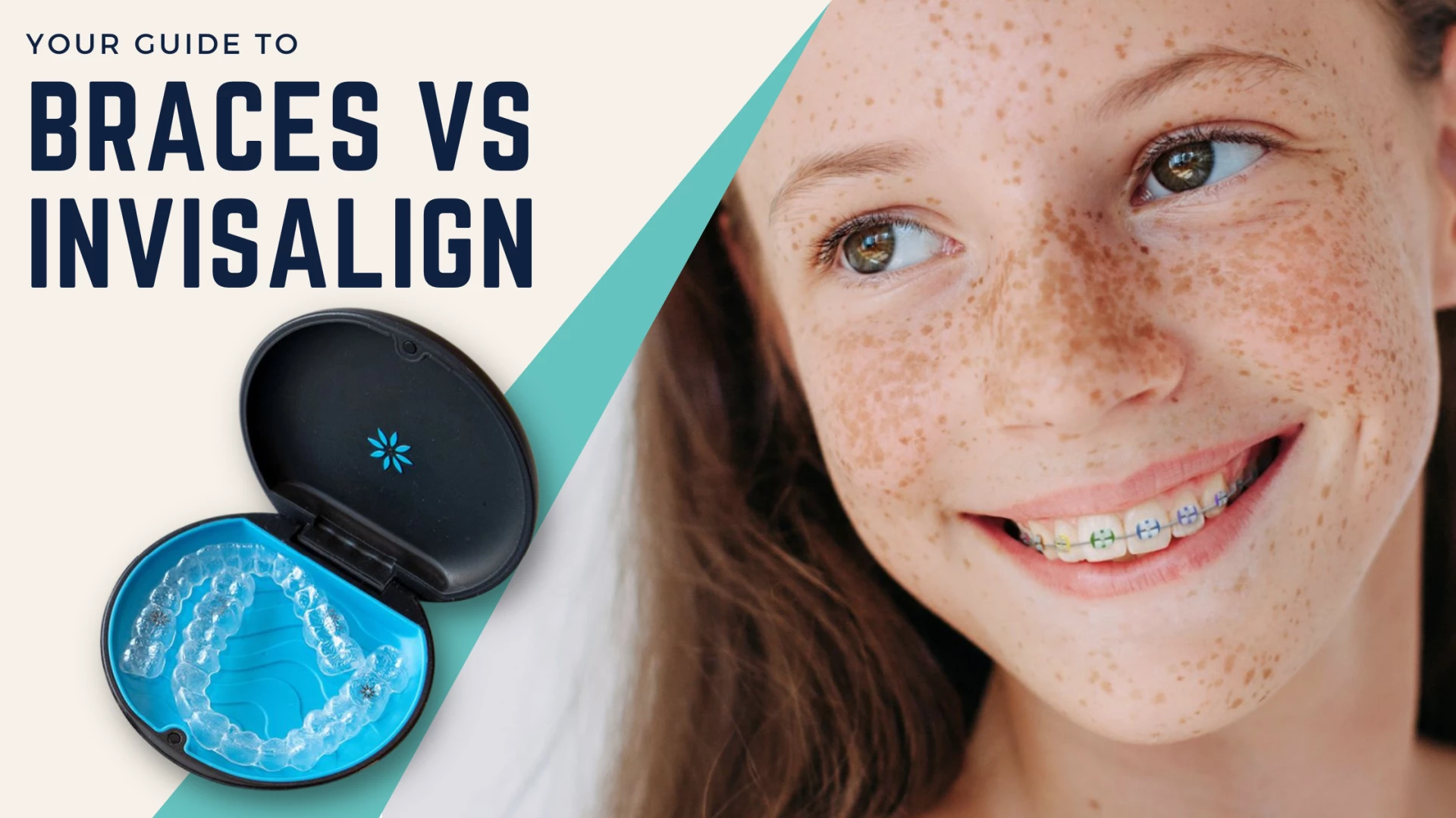 Invisalign Vs Braces - Which Is The Best Orthodontic Treatment For Your  Smile - Sandy Smiles Orthodontics